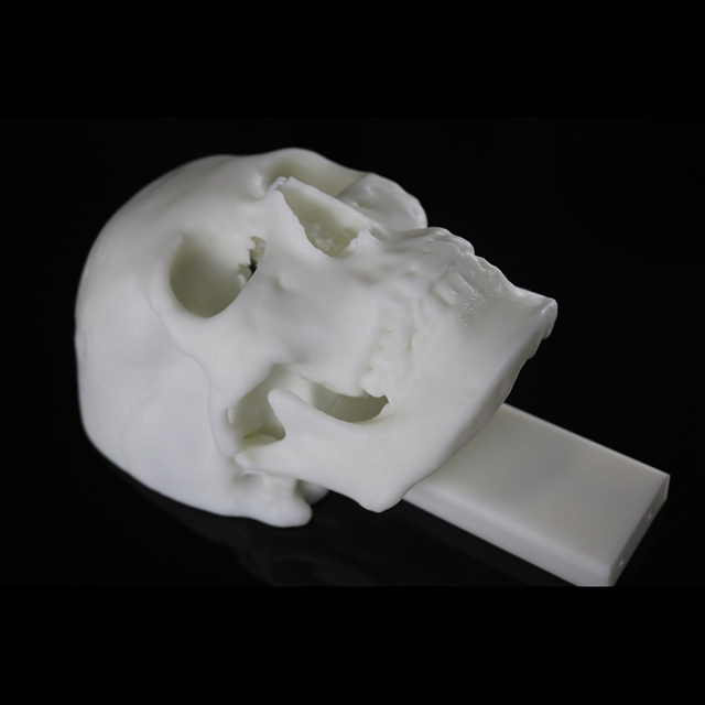 SLA 3D Printing Resin Material for Preoperative Skull Planning